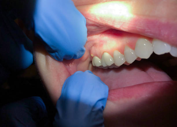 Best Weekend Emergency Dentist in Bellmead, TX