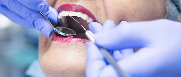 Best Emergency Wisdom Teeth Removal in Bellmead, TX